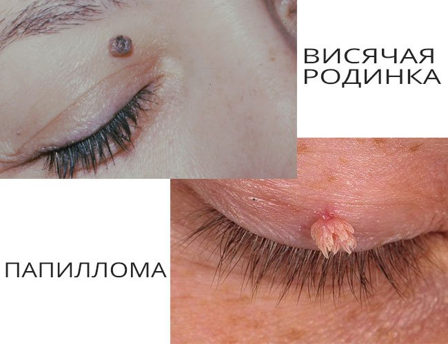 Как себе сделать родинку в домашних условиях Как себе сделать родинку в домашних условиях