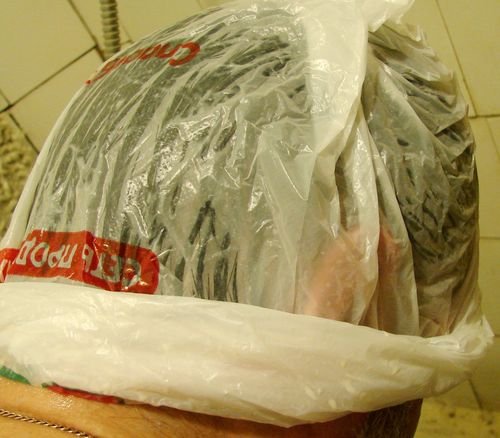 рост волос на макушке у женщин рост волос на макушке у женщин
