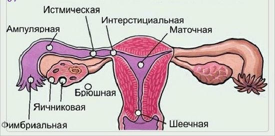 Боль внизу живота не связанная с беременностью Боль внизу живота не связанная с беременностью
