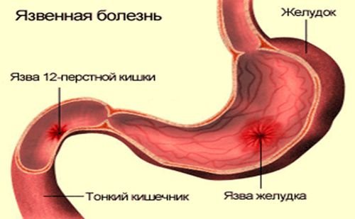 Ребенок 4 лет жалуется на боль в коленях