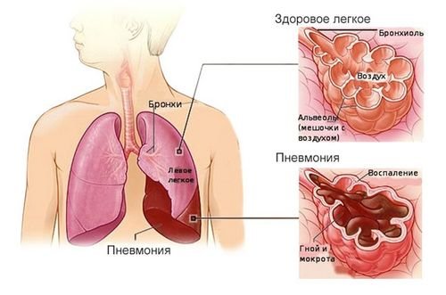 19 неделя беременности боли в промежности