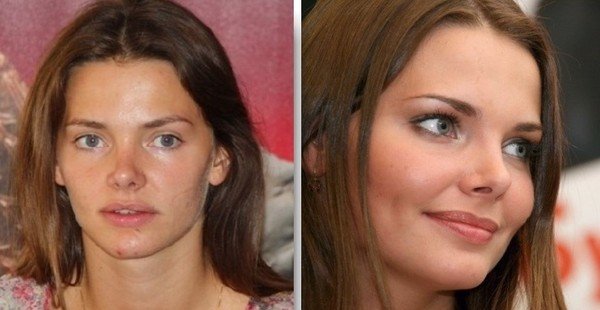 боярская лиза до пластики и после фото 2015 онлайн