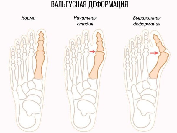 Когда применяют домашние средства
