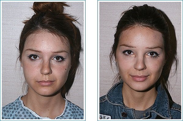 Комки биша в домашних условиях 342